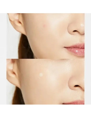 COSRX Acne Pimple Master Patch - Parches Antiacné