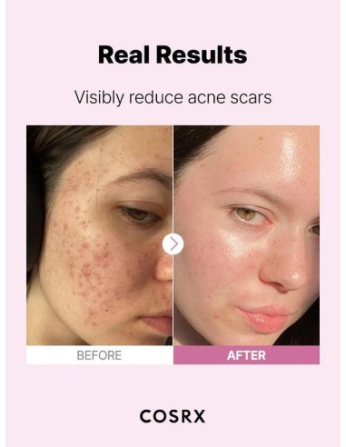 COSRX The Niacinamide 15 Serum - Sérum Niacinamida