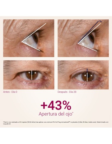 SINGULADERM Xpert Collageneur Contorno Ojos 15 ml