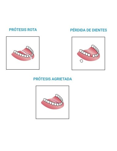 PROTESAN MONO Reparador Dentaduras Postizas Rotas y Fijador de Dientes