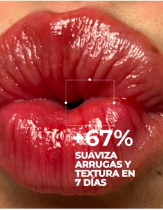 Nuxe Very rose agua micelar hidratante 3 en 1 para pieles sensibles secas a muy secas 200ml 2