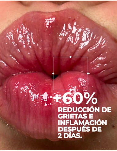 Nuxe Very rose agua micelar hidratante 3 en 1 para pieles sensibles secas a muy secas 200ml