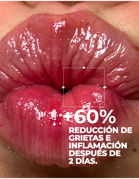 Nuxe Very rose agua micelar hidratante 3 en 1 para pieles sensibles secas a muy secas 200ml