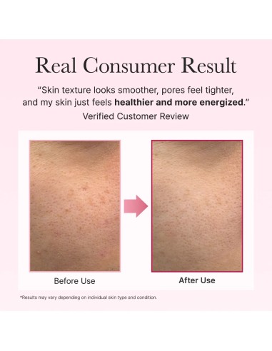 ARENCIA PDRN Booster Shot - Booster PDRN Cara y Ojos