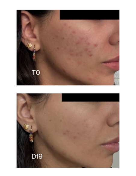 SENSILIS Pure 15AZ Sérum Concentrado Global Anti-Imperfecciones 30 ml
