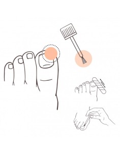 PRANARÔM AROMADERM Solución Uñas BIO 10 ml 2